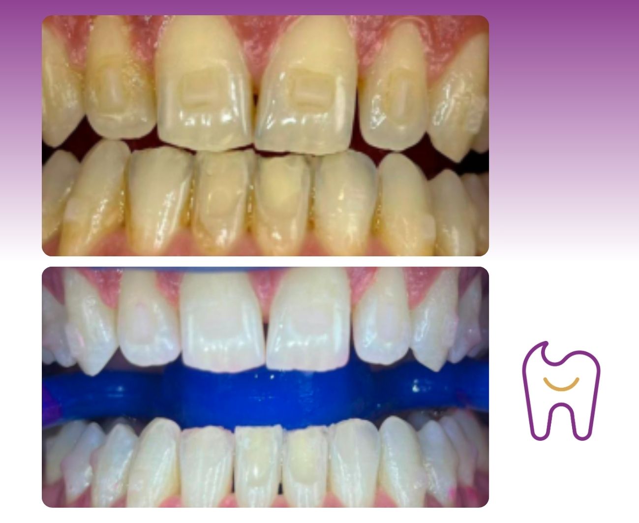 Dentální hygiena Smile Centrum